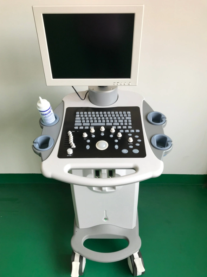 15&quot; LED 3D Ob Gyn Obstetrics Trolley Ultrasound Machine 3D Trolley Ultrasound Device